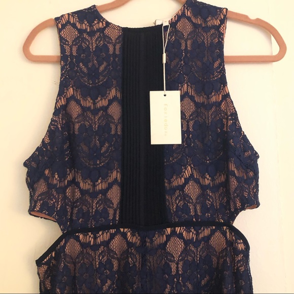 Blue Lace Foxiedox Romper - Picture 3 of 7